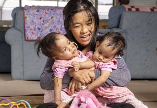 Kembar siam asal Bhutan Nima dan Dawa bersama ibu mereka, Bhumchu Zangmo, menjelang menjalani operasi di Melbourne, Australia. (Foto: EPA/BBC News)